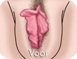 <strong>Geniet meteen van een strakkere vagina  zoals toen u 18 jaar oud was!</strong> <br />Bestel VAXS vandaag nog
